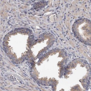Anti-ASIC5 antibody produced in rabbit 