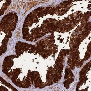 Anti-ASPDH antibody produced in rabbit 