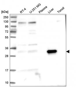 Anti-ASPDH antibody produced in rabbit 