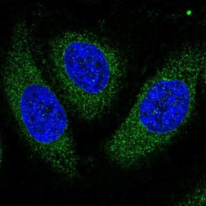 Anti-ASPH antibody produced in rabbit 