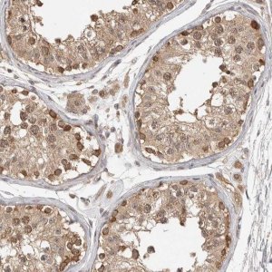 Anti-ASPSCR1 antibody produced in rabbit 
