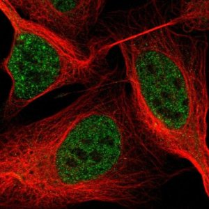 Anti-ASXL2 antibody produced in rabbit 