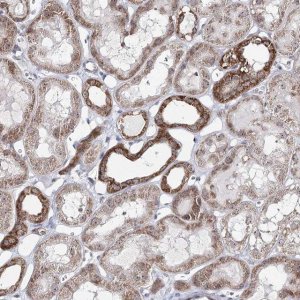Anti-ATAD1 antibody produced in rabbit 