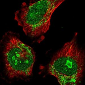 Anti-ATAD1 antibody produced in rabbit 