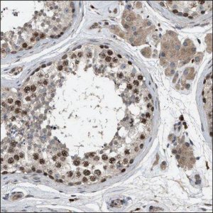 Anti-ATAD2 antibody produced in rabbit HPA019860-100UL