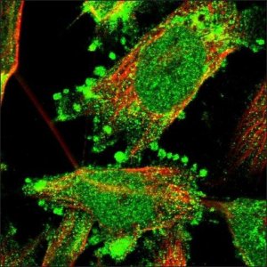 Anti-ATAD2 antibody produced in rabbit HPA019860-100UL