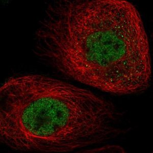 Anti-ATAD2B antibody produced in rabbit 