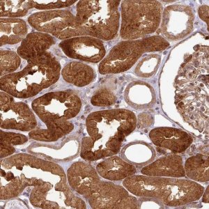 Anti-ATAT1 antibody produced in rabbit 