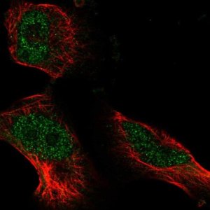 Anti-ATE1 antibody produced in rabbit 