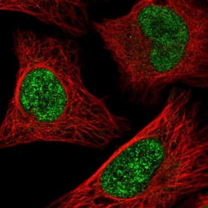 Anti-ATF1 antibody produced in rabbit 