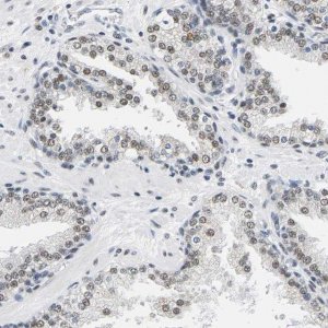 Anti-ATF2 antibody produced in rabbit 