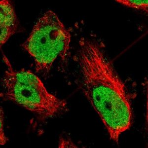 Anti-ATF2 antibody produced in rabbit 