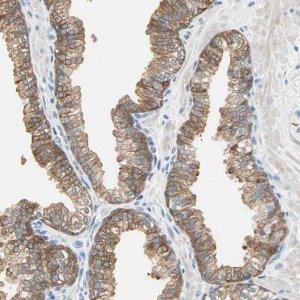 Anti-ATF6 antibody produced in rabbit 