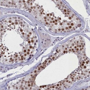 Anti-ATF7IP2 antibody produced in rabbit 