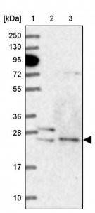 Anti-ATG101 antibody produced in rabbit 
