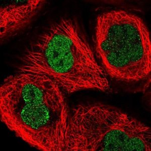 Anti-ATG16L2 antibody produced in rabbit 
