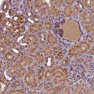 Anti-ATP10A antibody produced in rabbit 