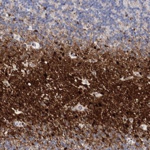 Anti-ATP10B antibody produced in rabbit 