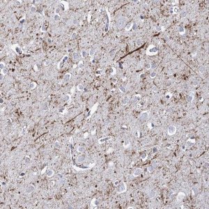 Anti-ATP10B antibody produced in rabbit 