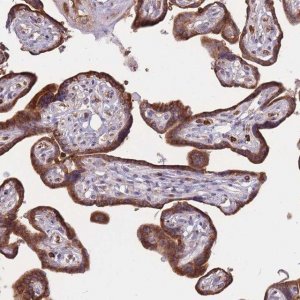Anti-ATP10D antibody produced in rabbit 