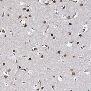 Anti-ATP11B antibody produced in rabbit 