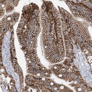 Anti-ATP11C antibody produced in rabbit 