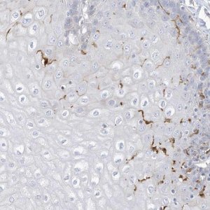 Anti-ATP13A1 antibody produced in rabbit 