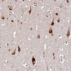 Anti-ATP13A2 antibody produced in rabbit 