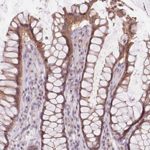 Anti-ATP1B3 antibody produced in rabbit 