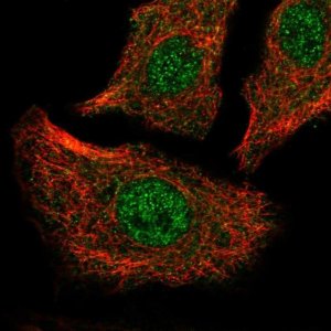 Anti-ATP2A2 antibody produced in rabbit 