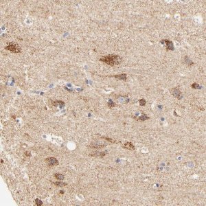 Anti-ATP5D antibody produced in rabbit 