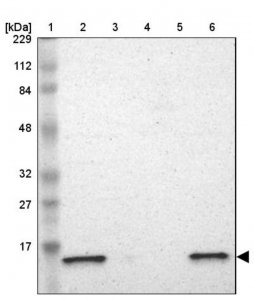 Anti-ATP5D antibody produced in rabbit 