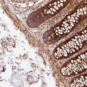 Anti-ATP6AP1L antibody produced in rabbit 