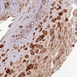 Anti-ATP6V0A2 antibody produced in rabbit 