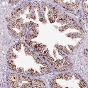 Anti-ATP6V1E2 antibody produced in rabbit HPA052784-100UL