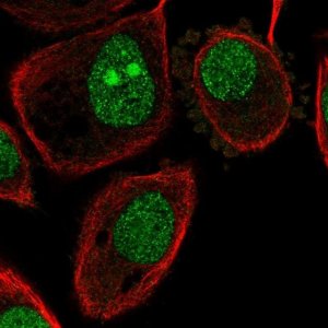 Anti-ATP6V1G1 antibody produced in rabbit 