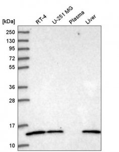 Anti-ATP6V1G1 antibody produced in rabbit 