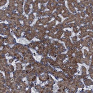 Anti-ATP7B antibody produced in rabbit 