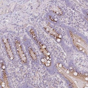 Anti-ATP8B2 antibody produced in rabbit 