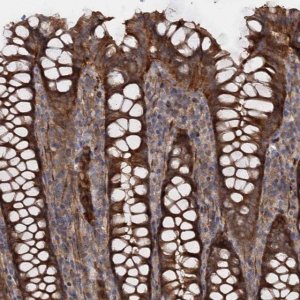 Anti-ATP8B4 antibody produced in rabbit 