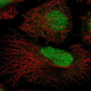 Anti-ATRIP antibody produced in rabbit 