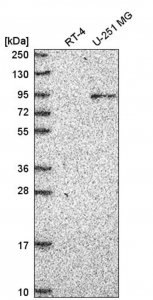Anti-ATRIP antibody produced in rabbit 