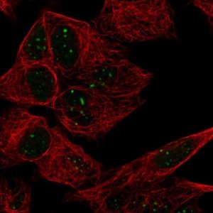Anti-ATRX antibody produced in rabbit 