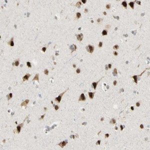 Anti-ATXN1 antibody produced in rabbit 