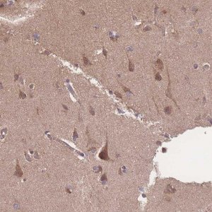 Anti-ATXN10 antibody produced in rabbit 