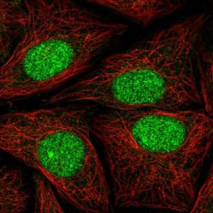 Anti-ATXN1L antibody produced in rabbit 