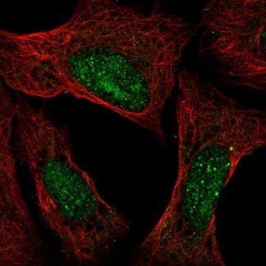Anti-ATXN3 antibody produced in rabbit 