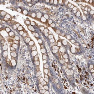 Anti-ATXN3L antibody produced in rabbit 