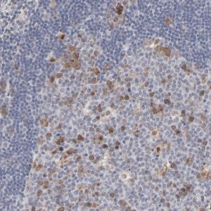 Anti-AURKA antibody produced in rabbit 