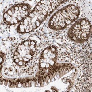 Anti-AURKAIP1 antibody produced in rabbit 